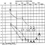 Newest Audiogram and Tests from UNC CI Eval