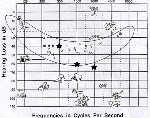 graph known as the speech banana graph known as the speech banana
