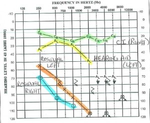 audiogram-11-09